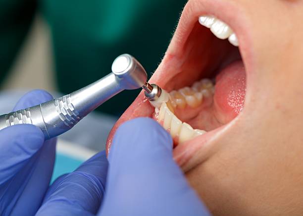 Best Root Canal Treatment  in Pine Grove, CA